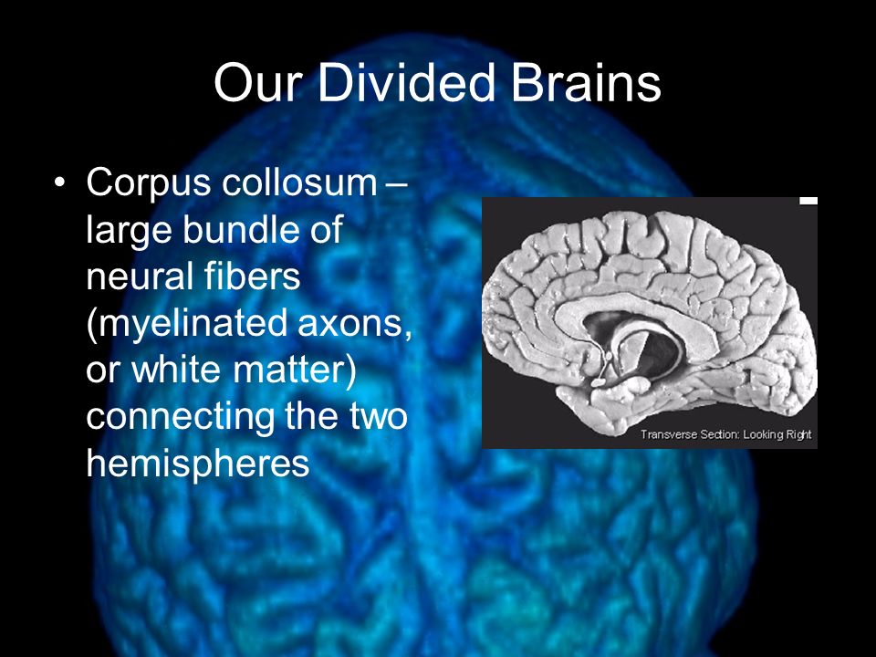 Our Divided Brains Corpus collosum – large bundle of neural fibers (myelinated axons, or white matter) connecting the two hemispheres.