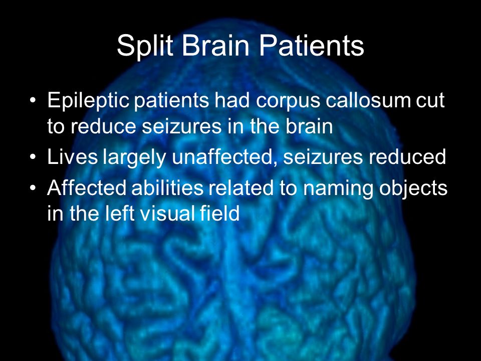 Split Brain Patients Epileptic patients had corpus callosum cut to reduce seizures in the brain. Lives largely unaffected, seizures reduced.