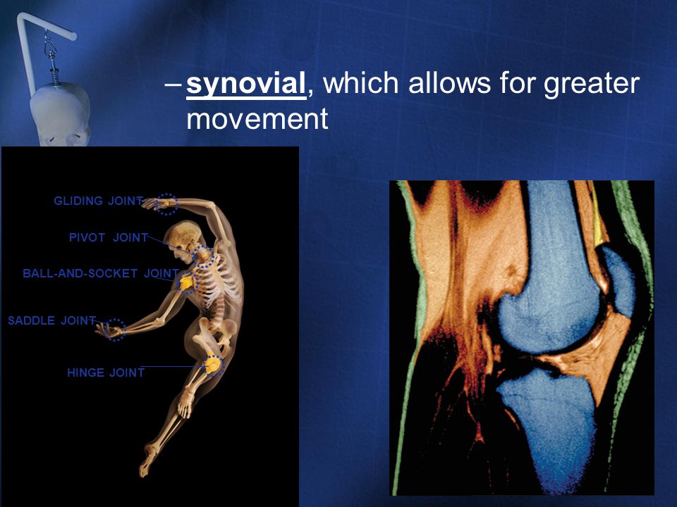 synovial, which allows for greater movement