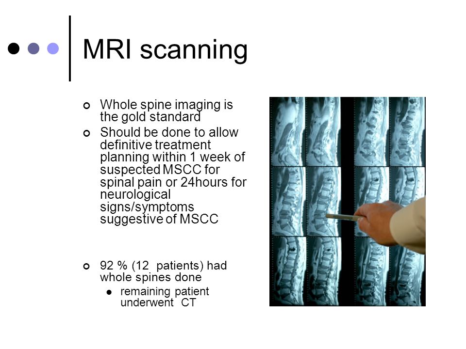 MRI scanning Whole spine imaging is the gold standard