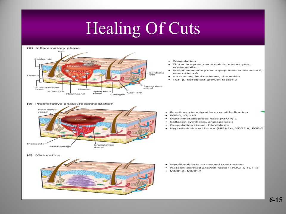 Healing Of Cuts 6-15