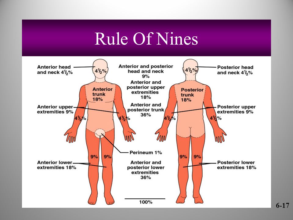 Rule Of Nines 6-17