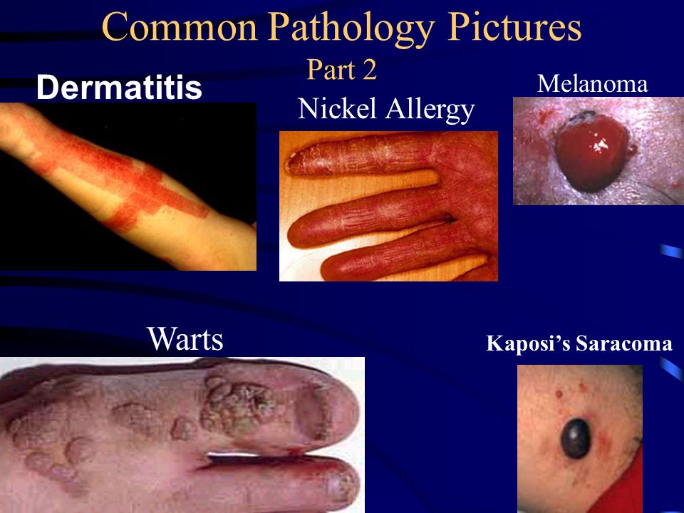 Common Pathology Pictures Part 2