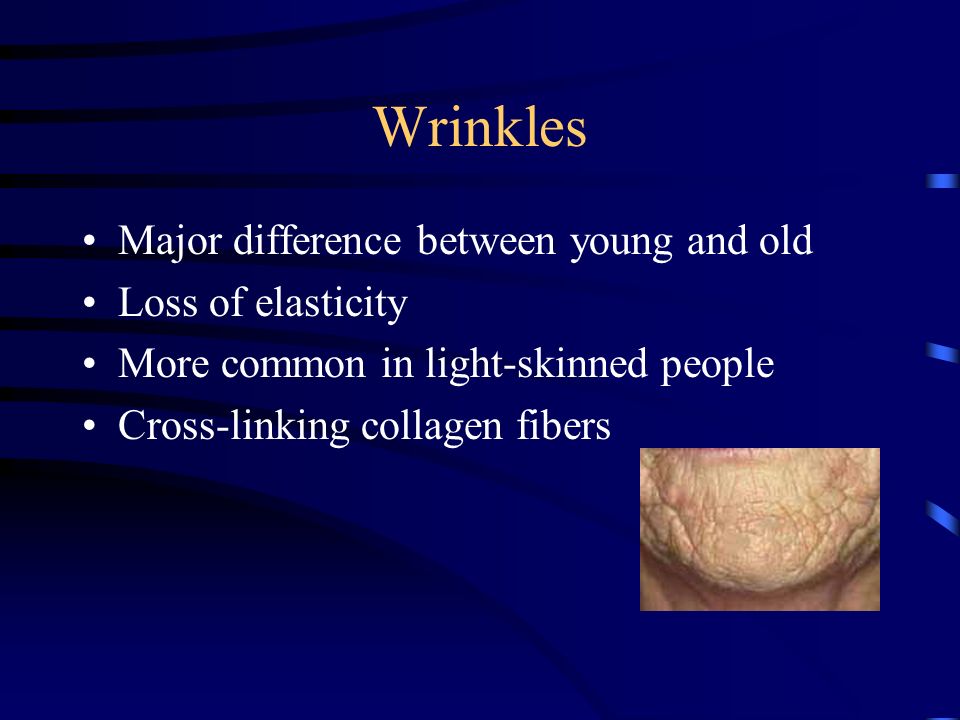 Wrinkles Major difference between young and old Loss of elasticity