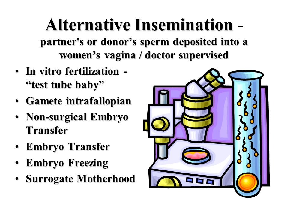 Alternative Insemination - partner s or donor’s sperm deposited into a women’s vagina / doctor supervised