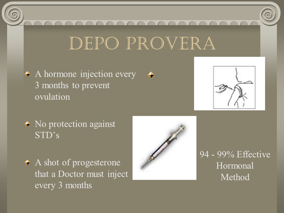 Depo Provera A hormone injection every 3 months to prevent ovulation
