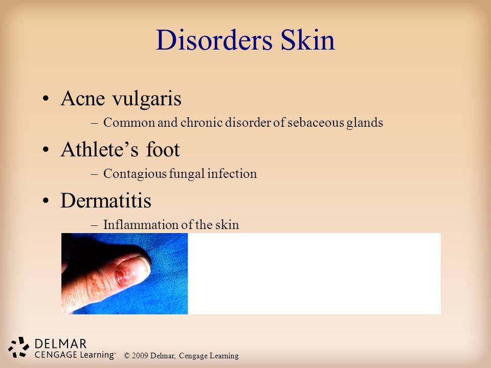 Disorders Skin Acne vulgaris Athlete’s foot Dermatitis