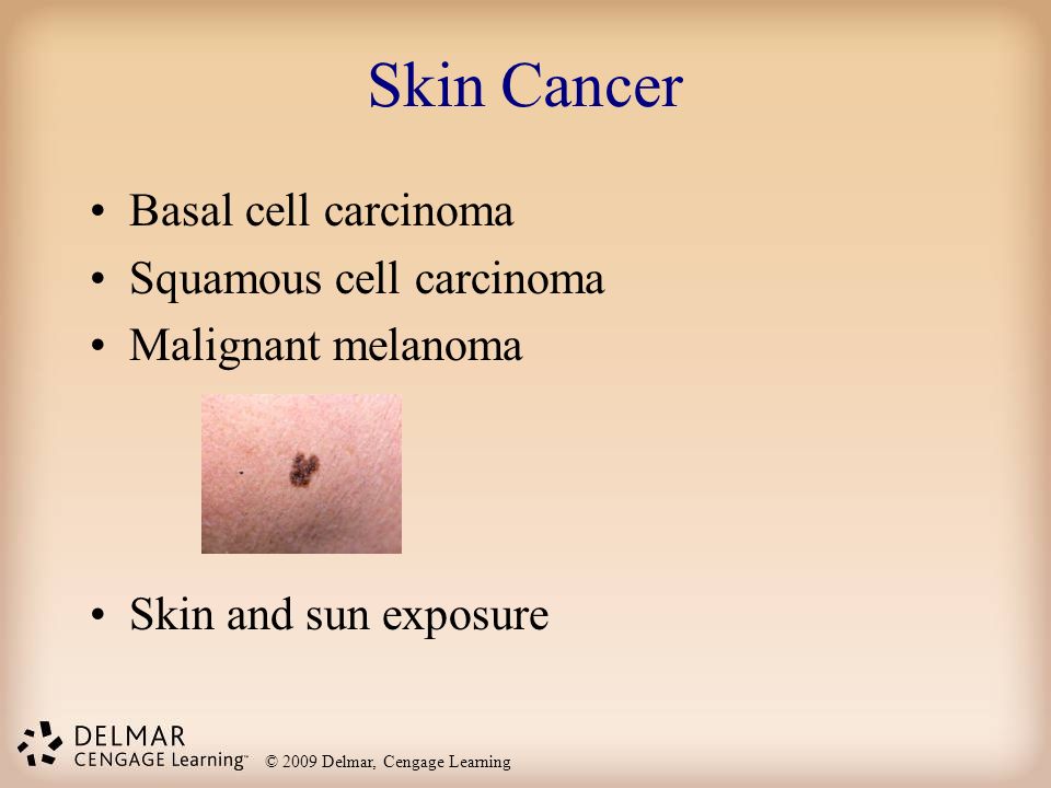Skin Cancer Basal cell carcinoma Squamous cell carcinoma