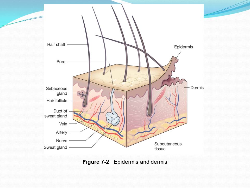 Figure 7-2 Epidermis and dermis