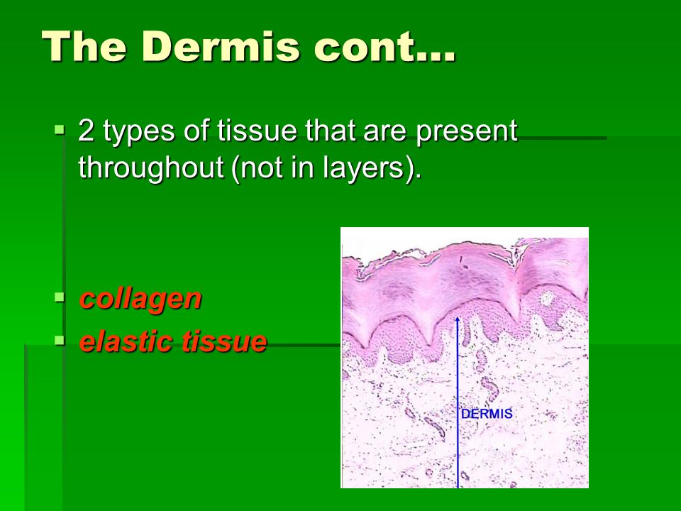 The Dermis cont… 2 types of tissue that are present throughout (not in layers).