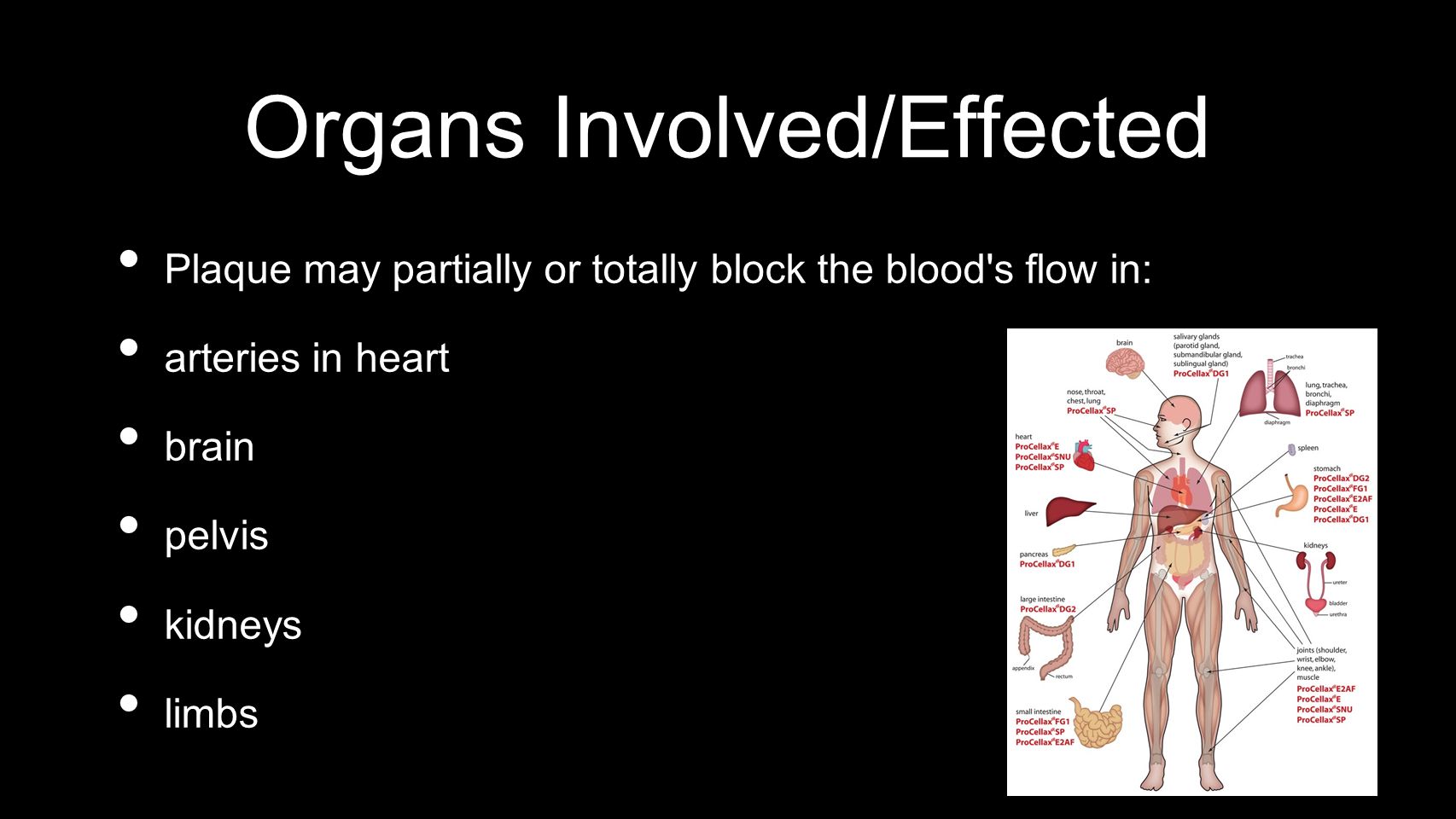 Organs Involved/Effected