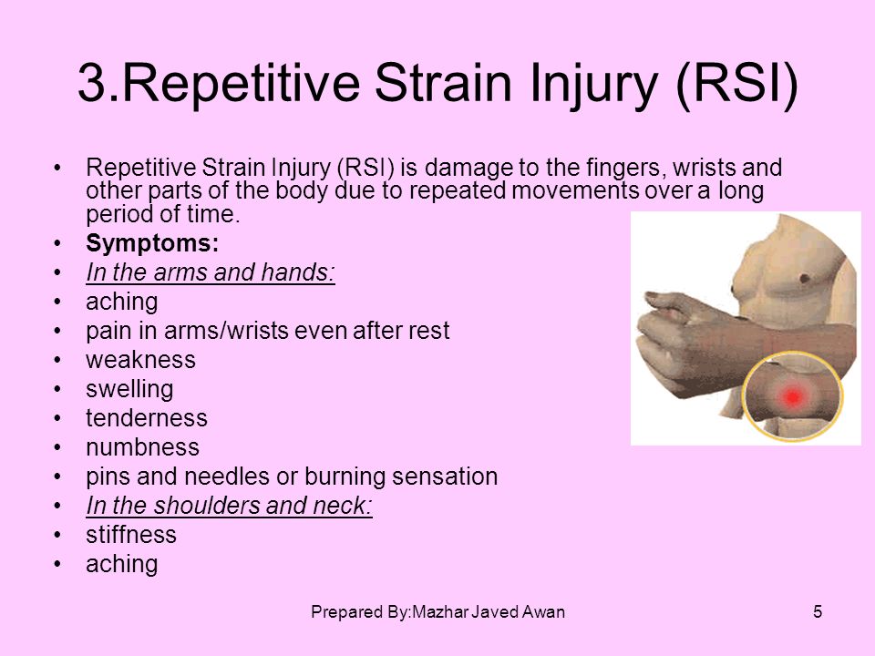 3.Repetitive Strain Injury (RSI)