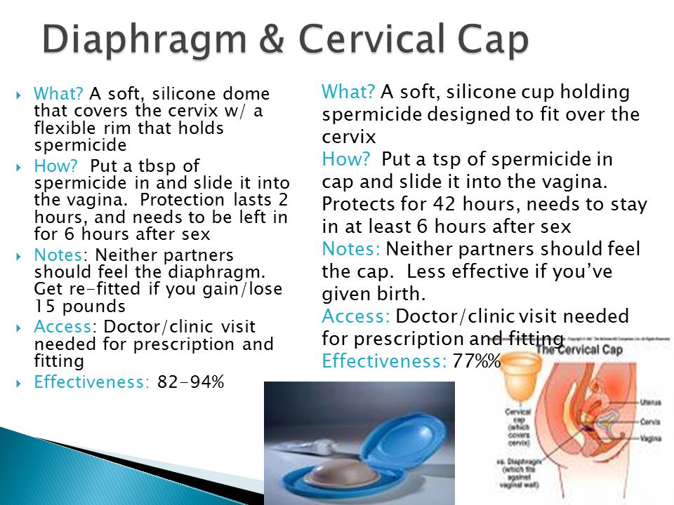 Diaphragm & Cervical Cap