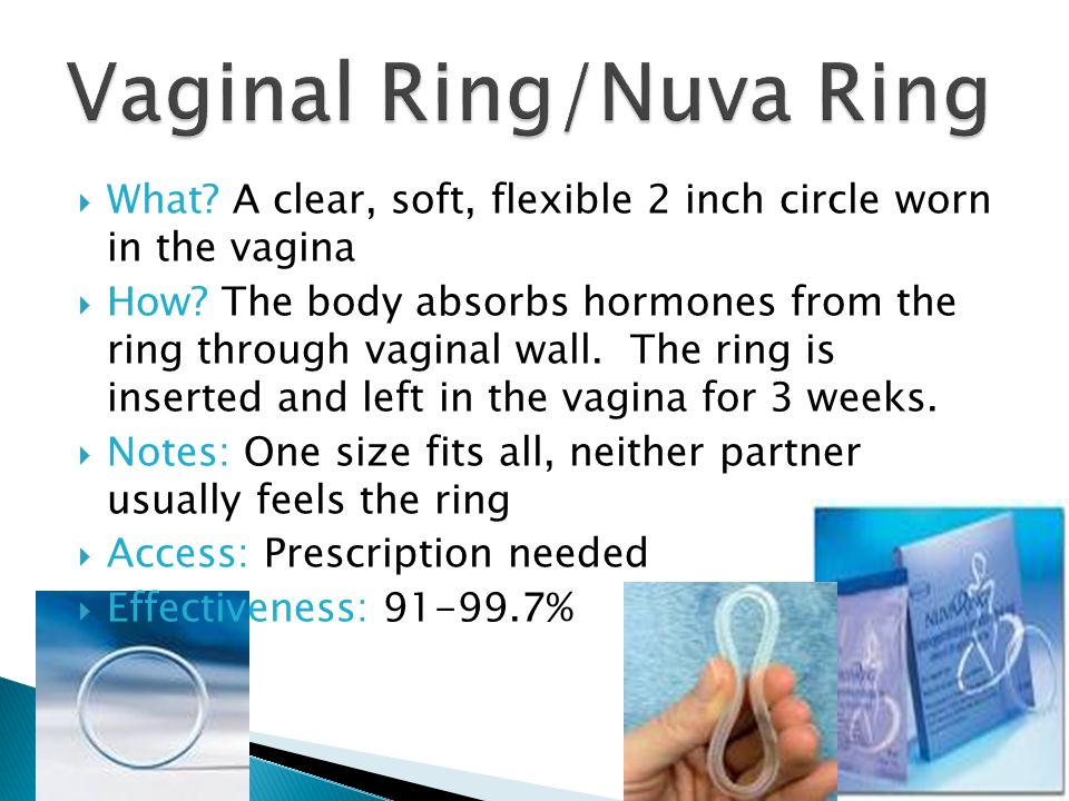 Vaginal Ring/Nuva Ring