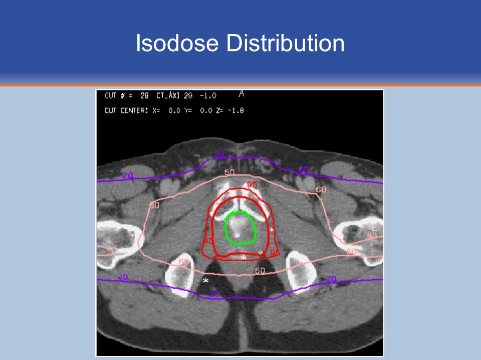 Isodose Distribution