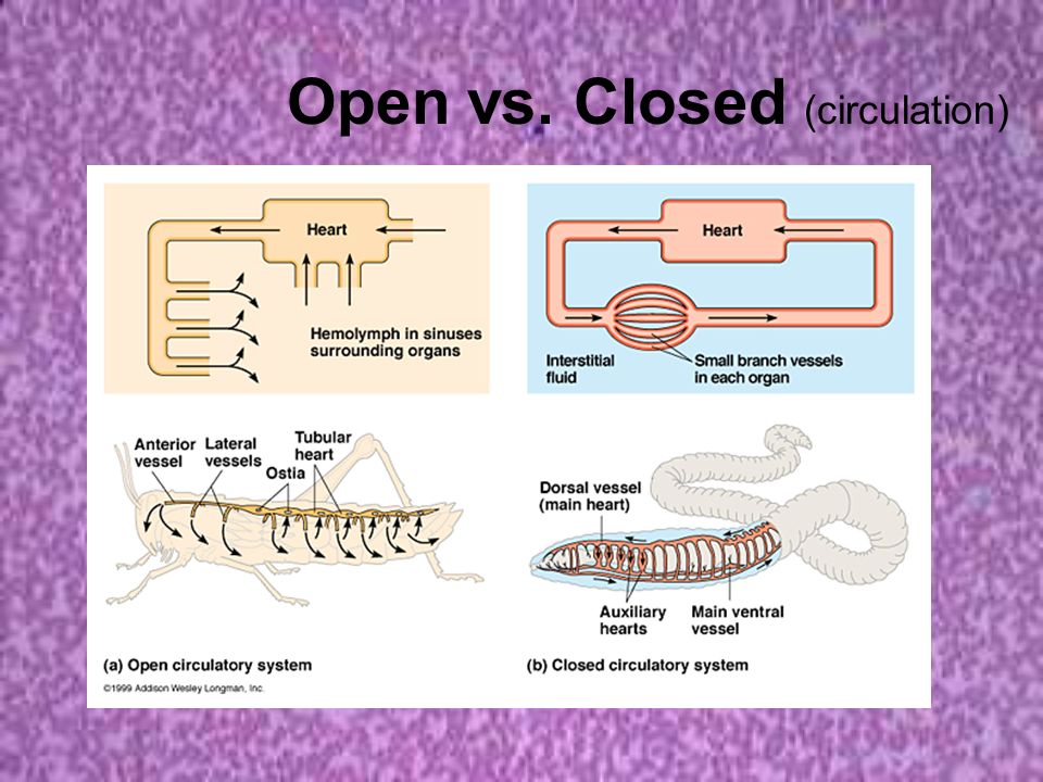 Open vs. Closed (circulation)