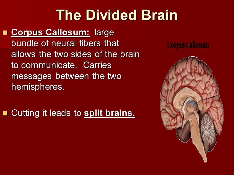 The Divided Brain
