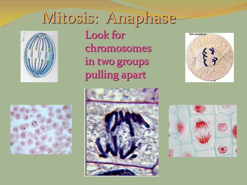Mitosis: Anaphase Look for chromosomes in two groups pulling apart