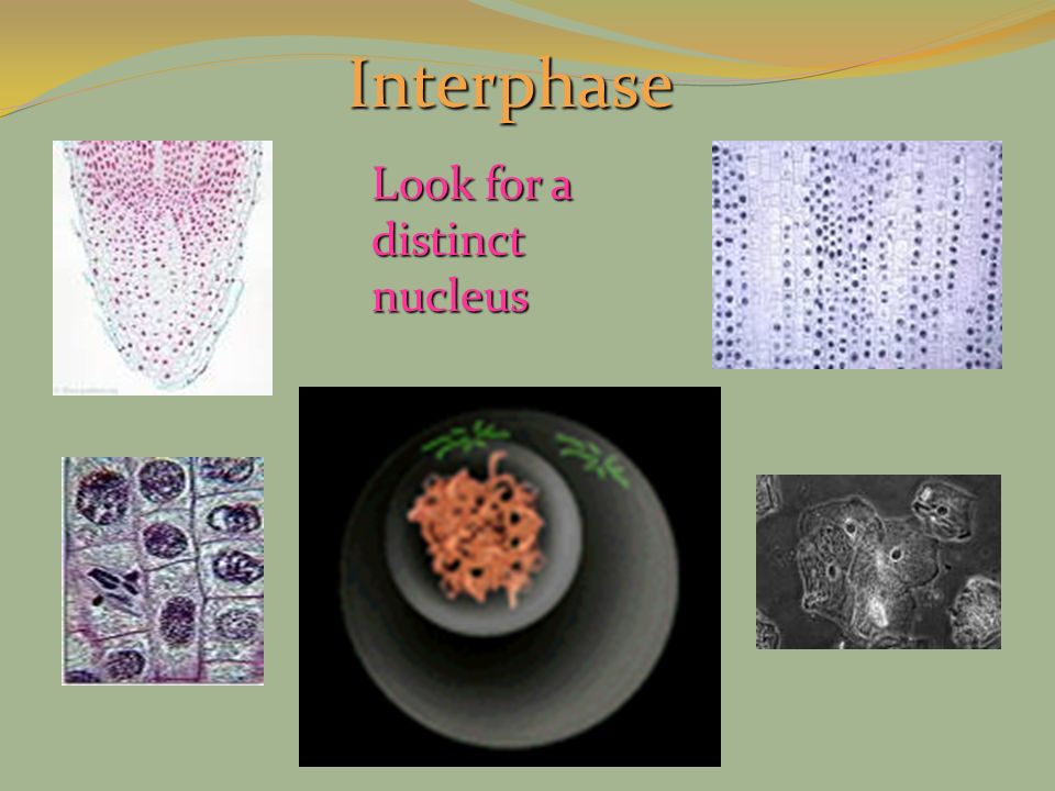 Interphase Look for a distinct nucleus