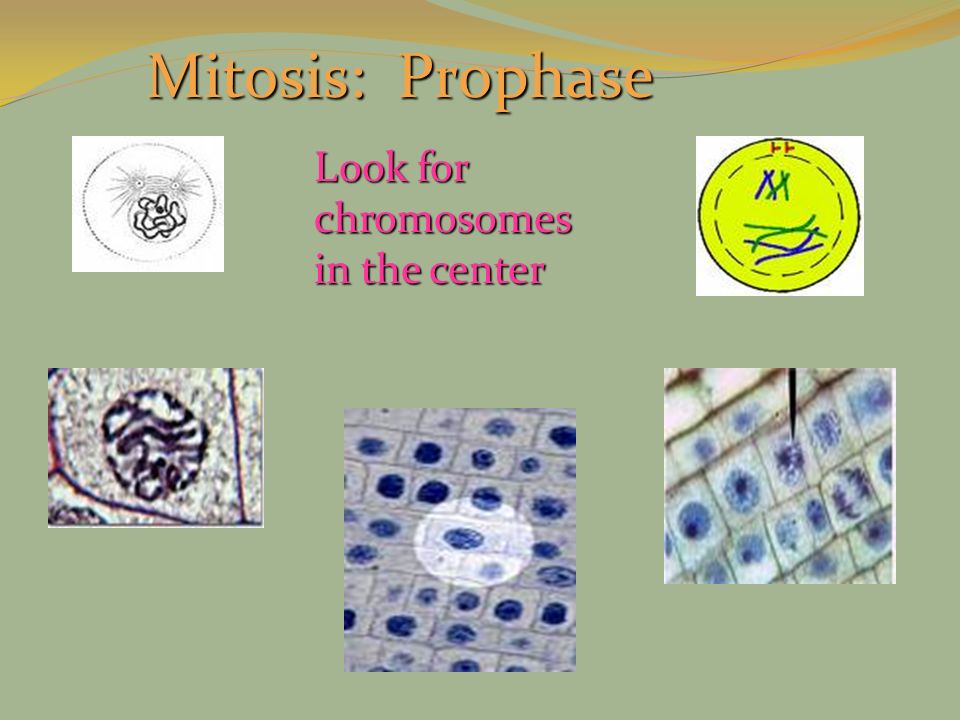 Mitosis: Prophase Look for chromosomes in the center