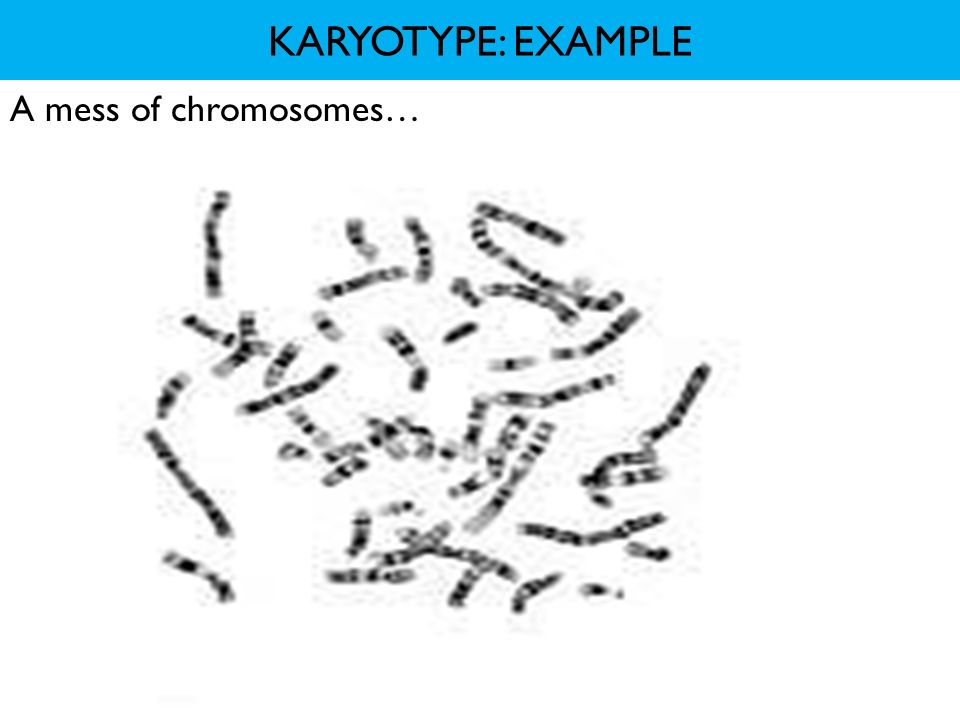 KARYOTYPE: EXAMPLE A mess of chromosomes…