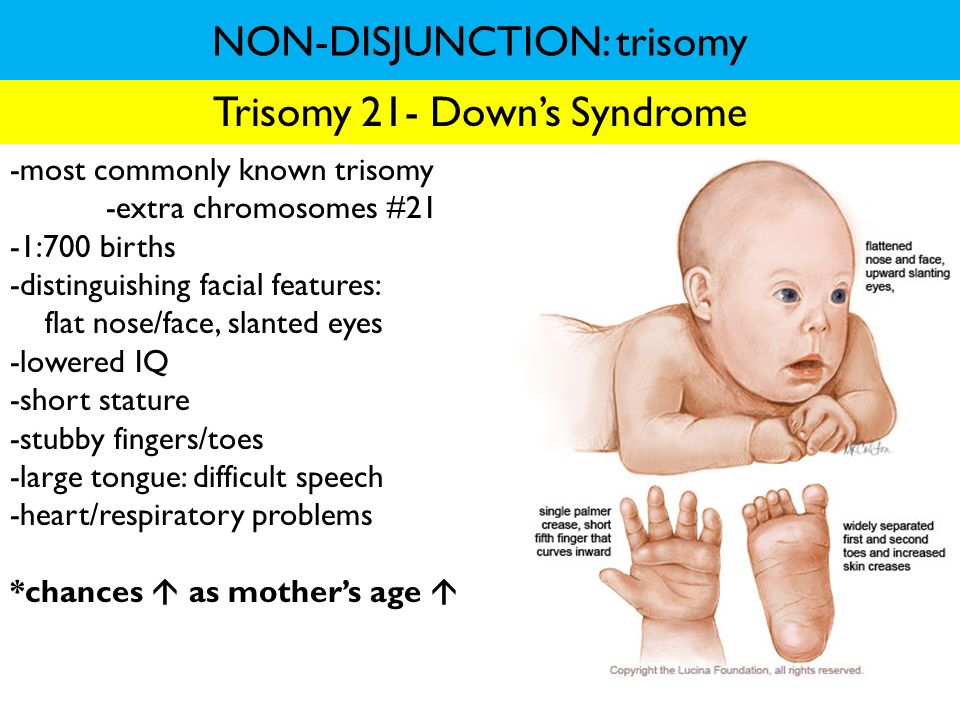 NON-DISJUNCTION: trisomy