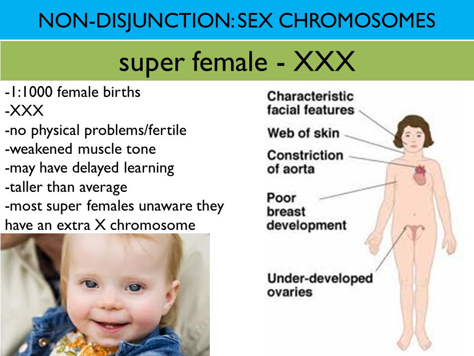 NON-DISJUNCTION: SEX CHROMOSOMES