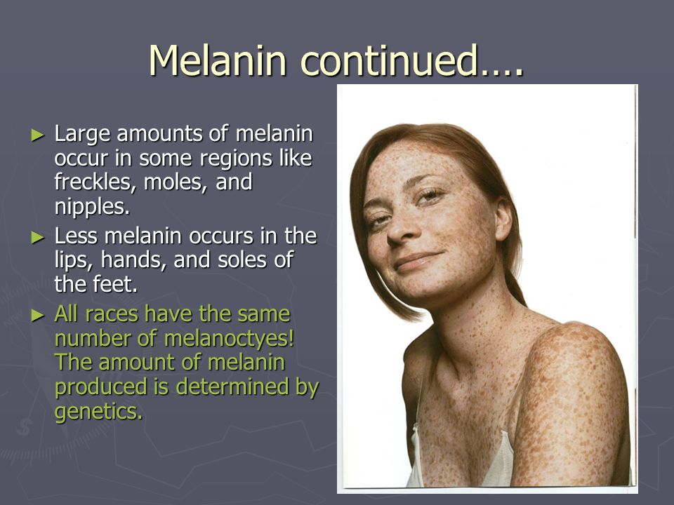 Melanin continued…. Large amounts of melanin occur in some regions like freckles, moles, and nipples.