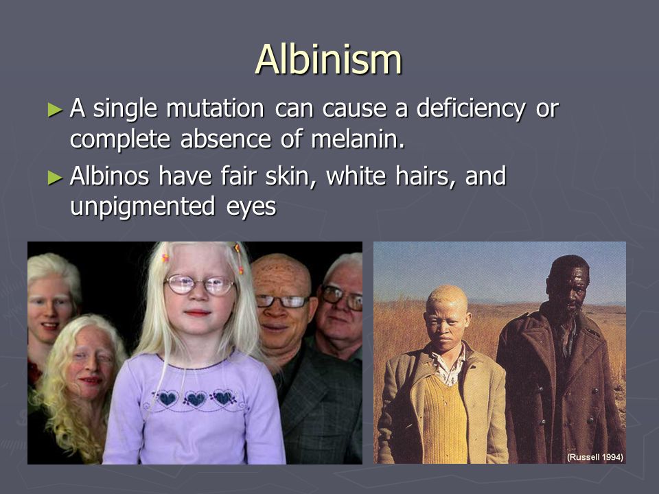 Albinism A single mutation can cause a deficiency or complete absence of melanin.