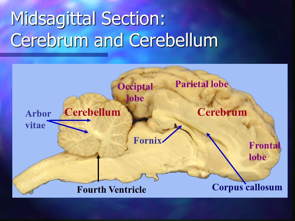 cerebellum - consists of folia (folds) of gray matterarbor vitae
