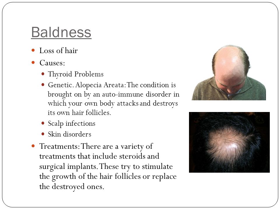 Baldness Loss of hair Causes:
