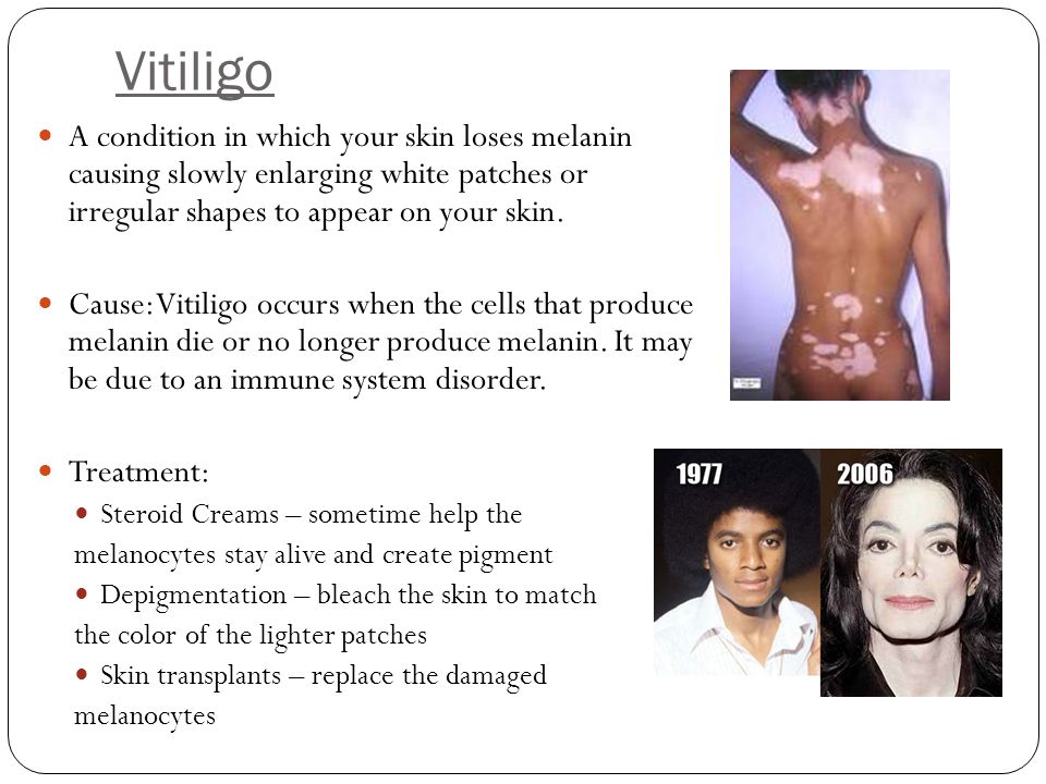 Vitiligo A condition in which your skin loses melanin causing slowly enlarging white patches or irregular shapes to appear on your skin.