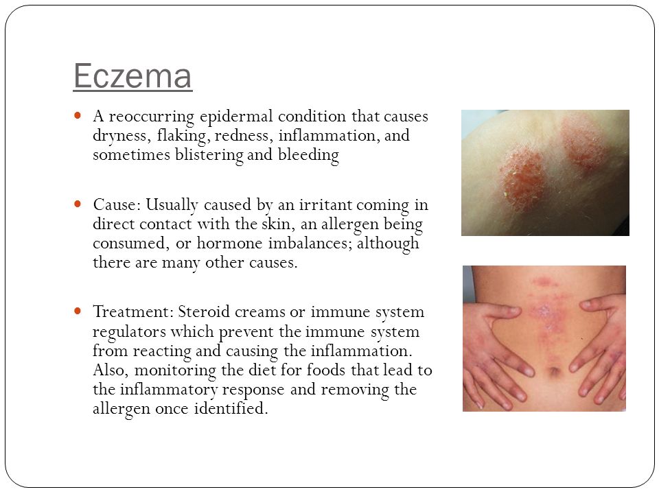 Eczema A reoccurring epidermal condition that causes dryness, flaking, redness, inflammation, and sometimes blistering and bleeding.