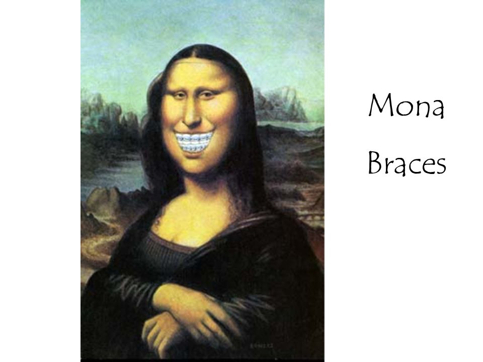 Mona Braces