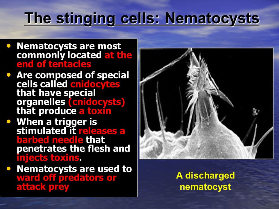 The stinging cells: Nematocysts