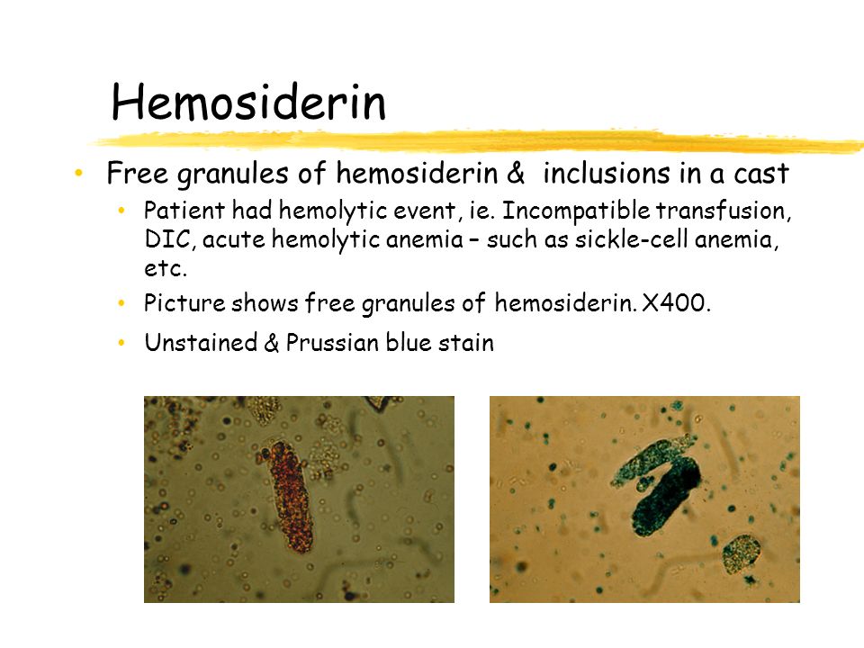 hemolytic,phagocytosis incompatible transfusion, dic, acute hemolytic anemia – such
