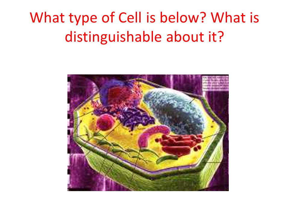 What type of Cell is below What is distinguishable about it