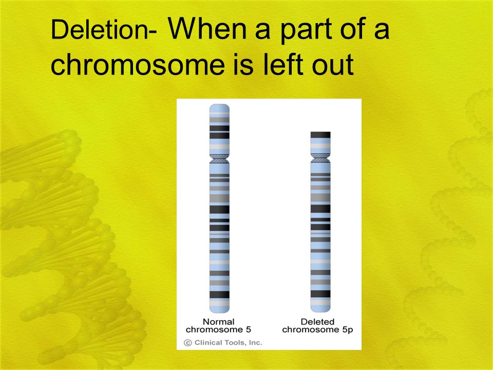 Deletion- When a part of a chromosome is left out