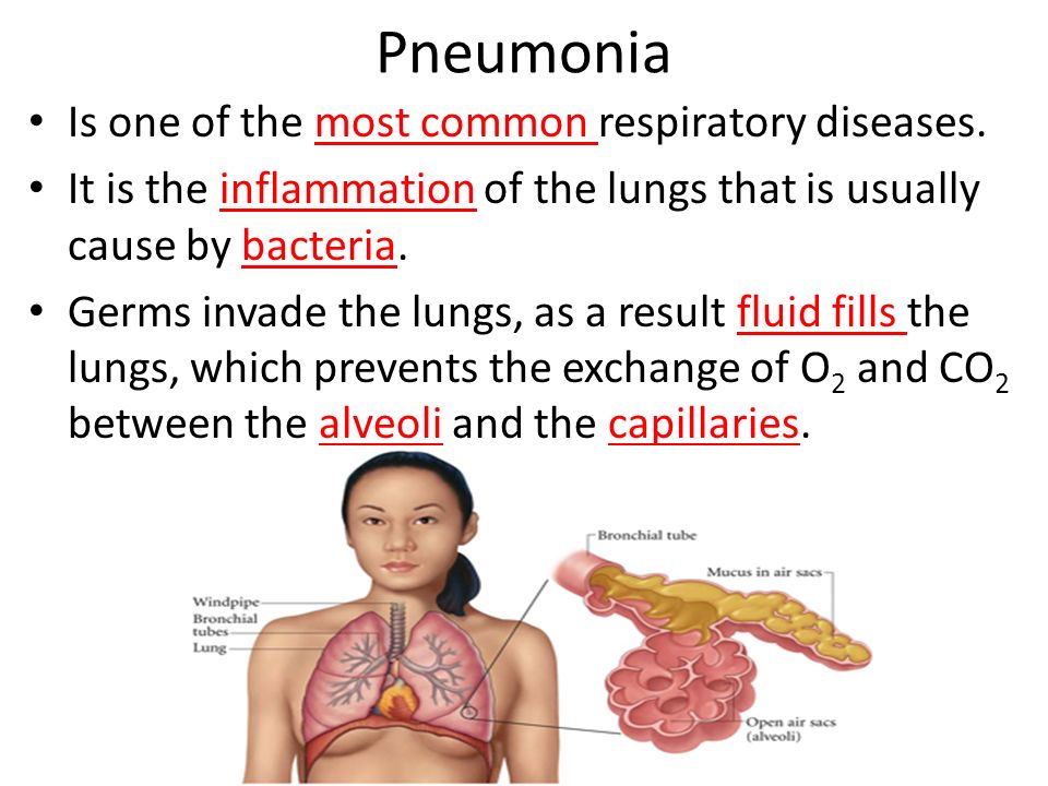 Pneumonia Is one of the most common respiratory diseases.