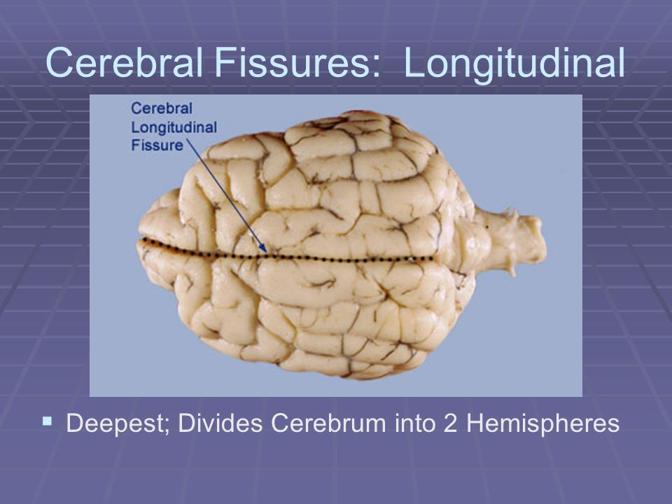 longitudinal fissure,thalamus photos cerebral fissures fissures (4 major) longitudinal fissure