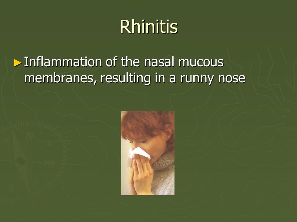 Rhinitis Inflammation of the nasal mucous membranes, resulting in a runny nose