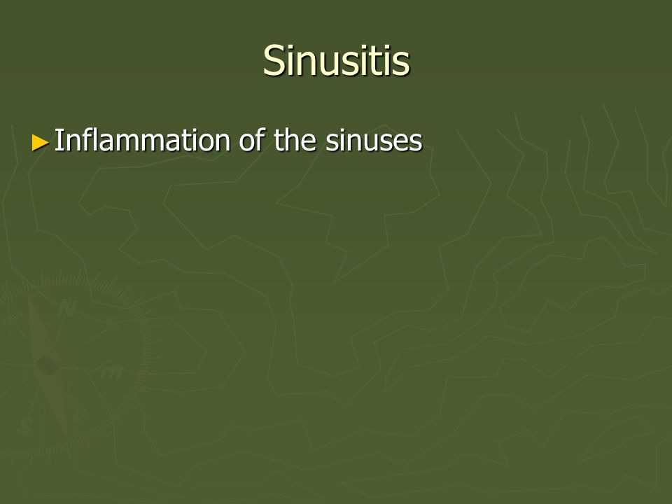Sinusitis Inflammation of the sinuses