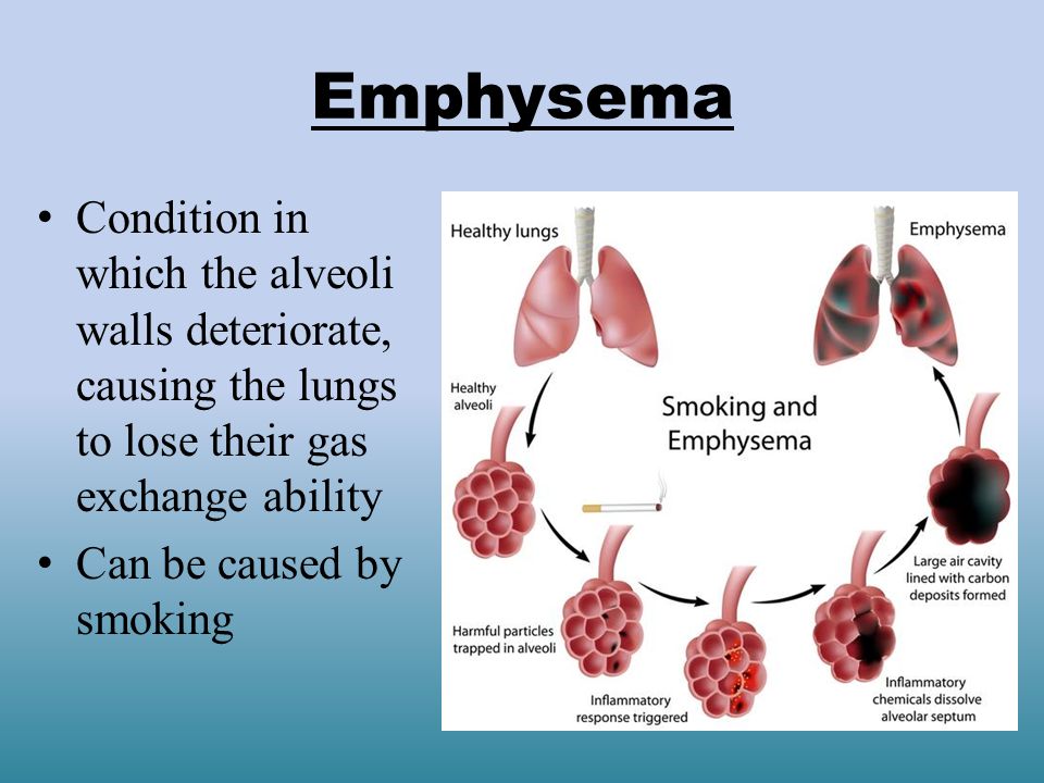 Emphysema Condition in which the alveoli walls deteriorate, causing the lungs to lose their gas exchange ability.