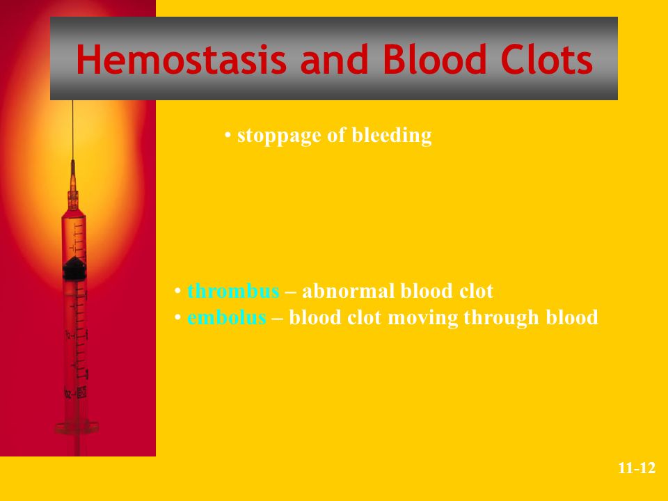 embolus,ventricular clots stoppage of bleedingthrombus ╟ abnormal blood clotembolus