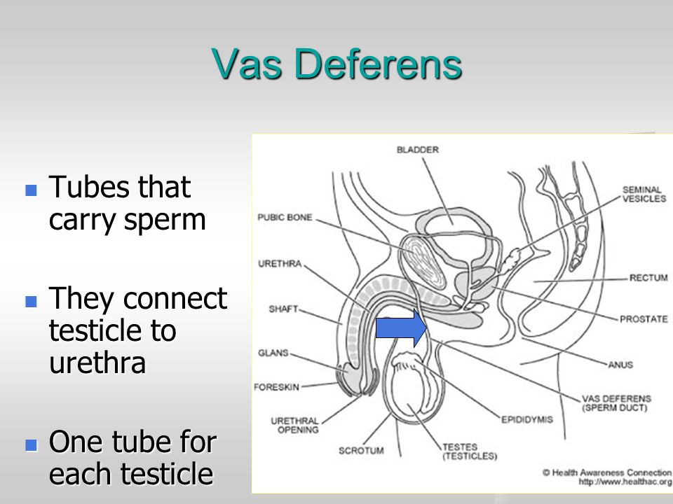 Vas deferens sperm blockage