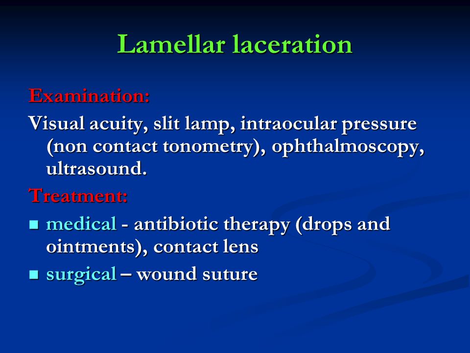 Lamellar laceration Examination: