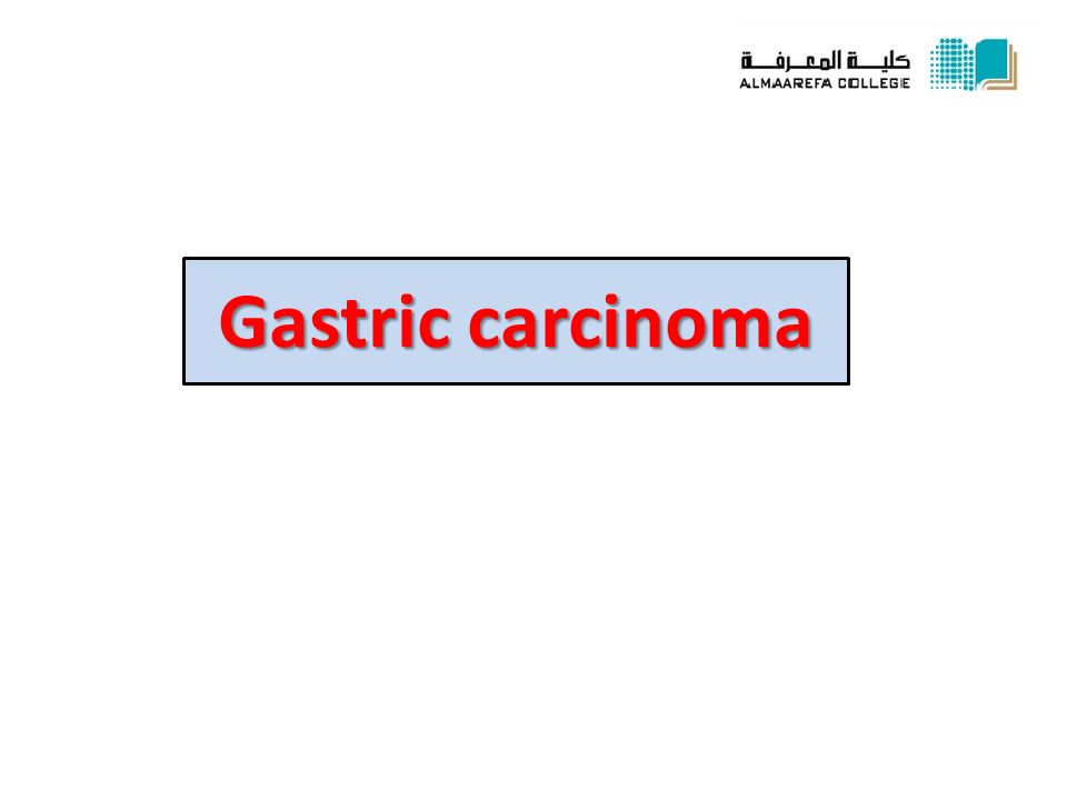 gastric carcinoma.