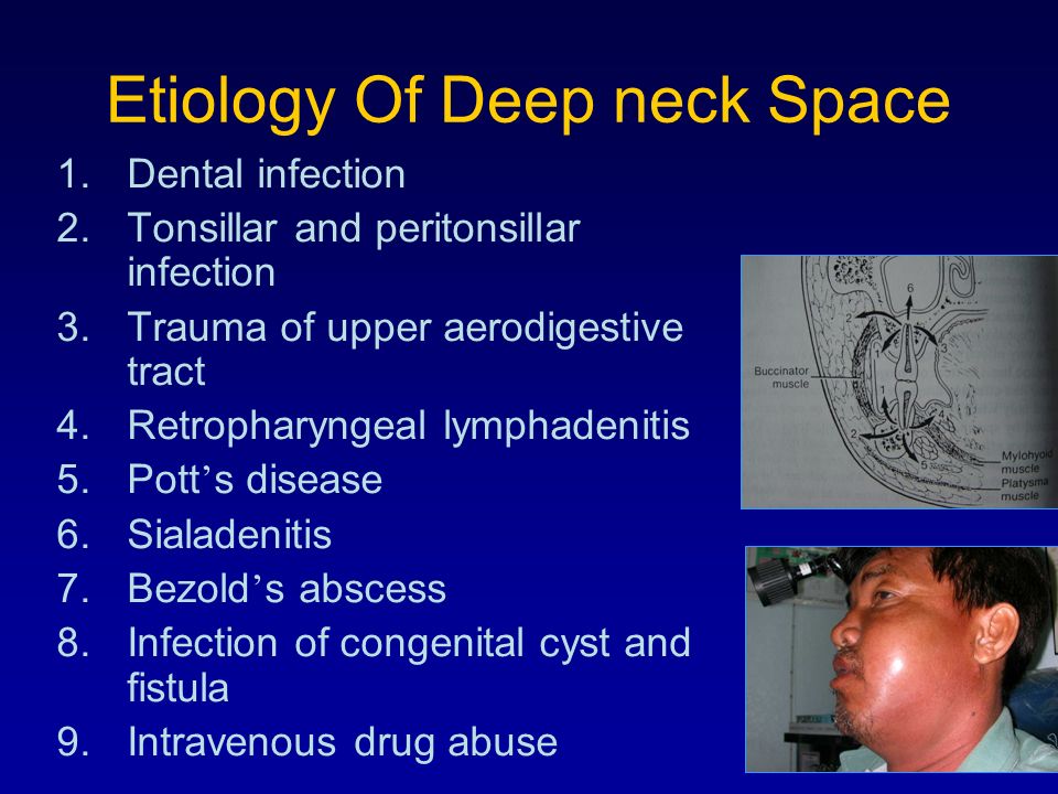 Deep neck