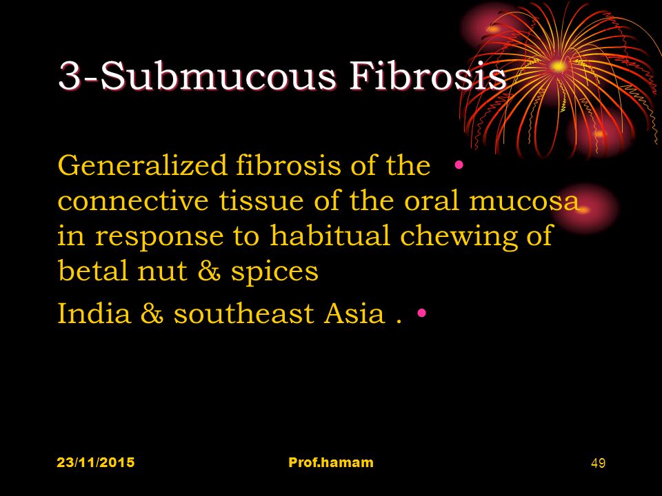 3-Submucous Fibrosis Generalized fibrosis of the connective tissue of the oral mucosa in response to habitual chewing of betal nut & spices.