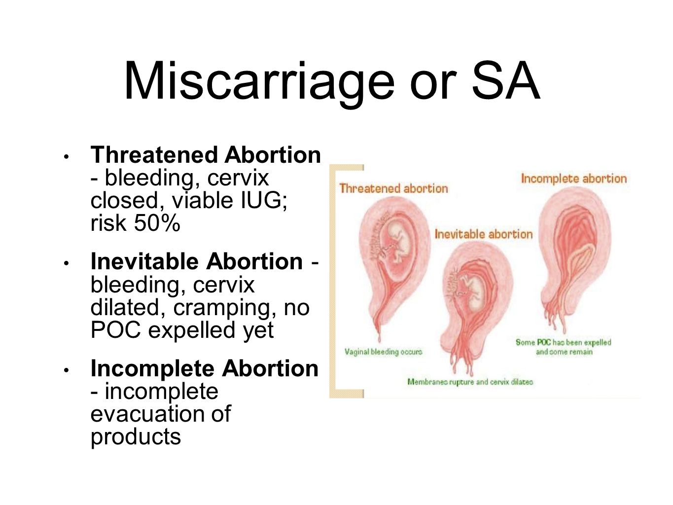 Masturbation linked to miscarriage